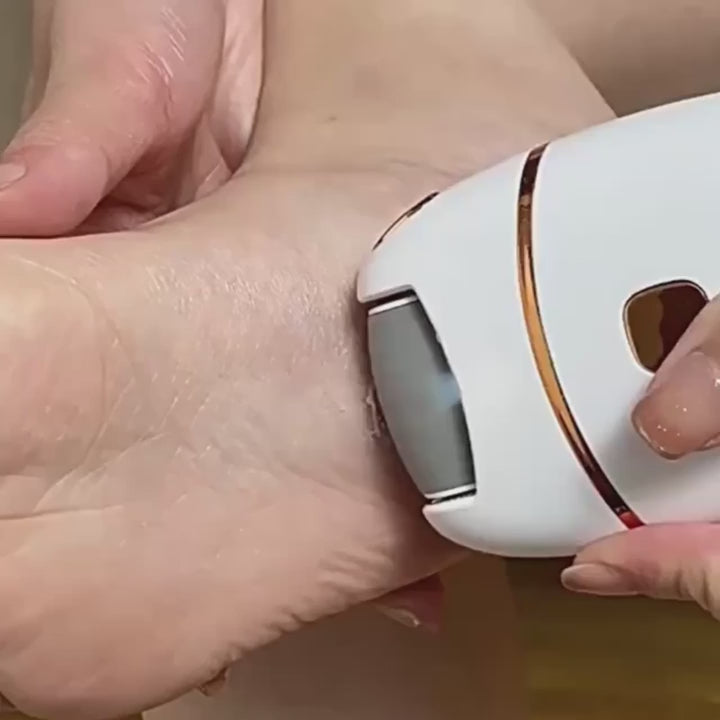 Electric Foot Grinder,Automatic ,To Remove Dead Skin and Calluses, Pedicure Stone, Heel Rubbing, Foot Skin Artifact